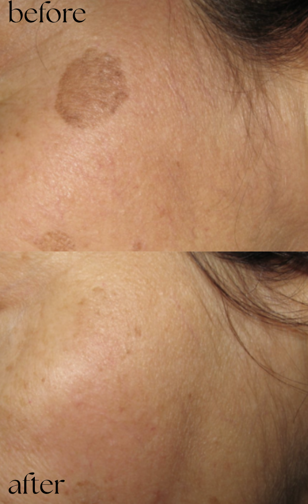 NDN.LASER kliniek in Almere