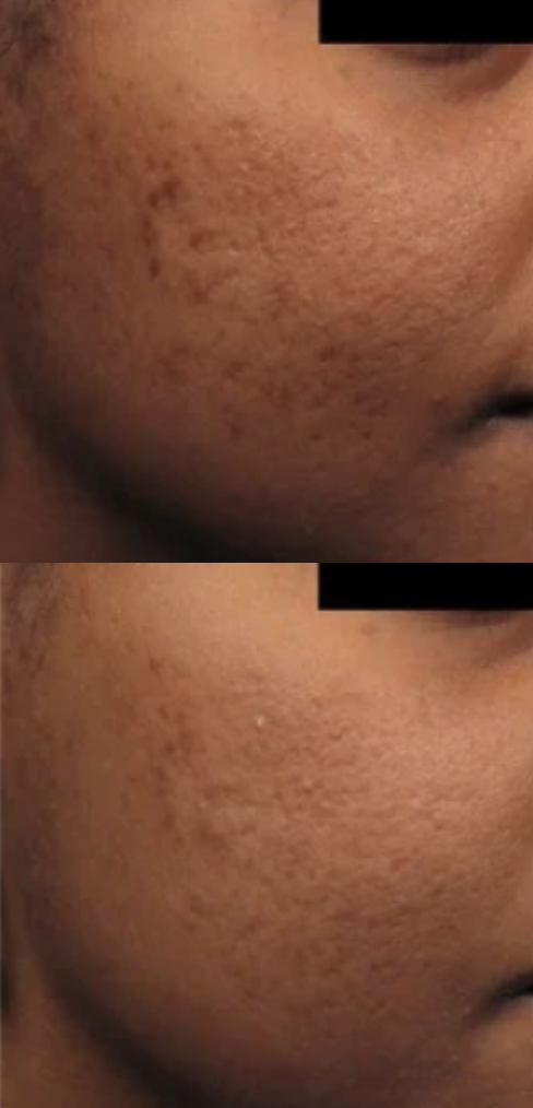 NDN.LASER kliniek in Almere